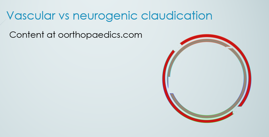Differences between vascular and neurogenic claudication