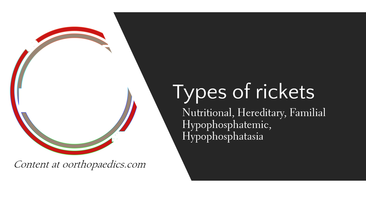 types of rickets